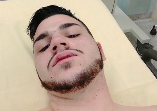 Caccia all’auto pirata che ha lasciato Valerio sanguinante in strada