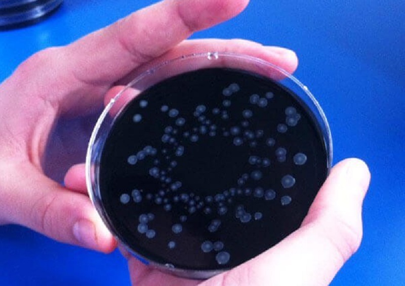 Legionella, termina l’allerta al campo sportivo di Garbagnate