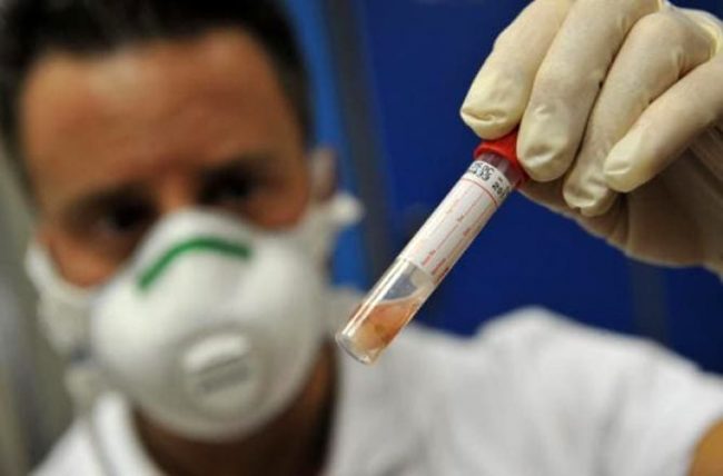 Meningite Lecco lieve miglioramento per la lecchese ricoverata al Manzoni