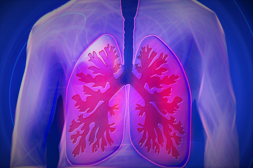 Tubercolosi polmonare, due casi correlati a Saronno