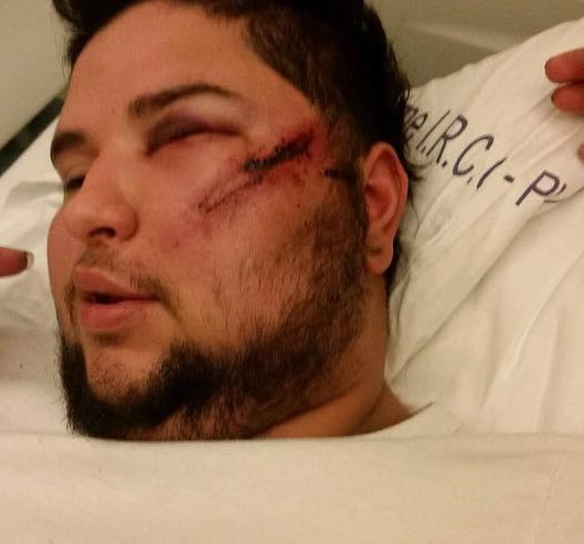 Aggredito a colpi di cric in faccia a Motta, la madre: “Attacco razzista”