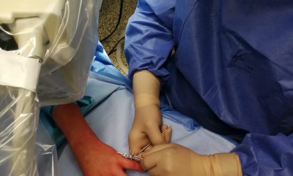 A Magenta nuova tecnica per curare le fratture della mano