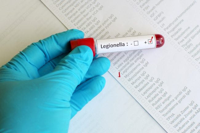Tre morti per legionella: il batterio non è nell’acquedotto
