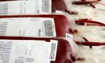 Virus West Nile in sacche di sangue per trasfusioni: il donatore non sapeva di essere infetto