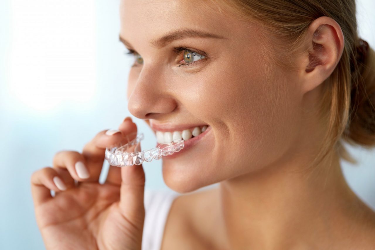 Impianti dentali: quali è meglio scegliere?