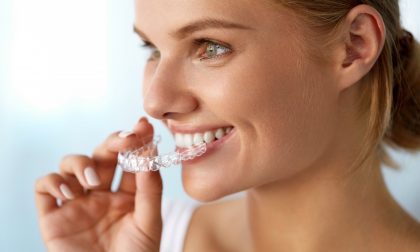 Impianti dentali: quali è meglio scegliere?