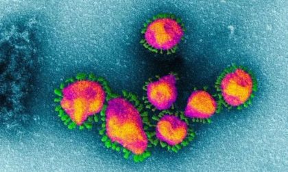 Coronavirus in Lombardia nella notte contagi saliti a 206