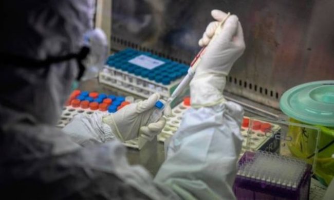 Ebola, negativi i test per i due pazienti ricoverati al Sacco
