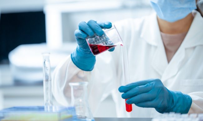 Giornata mondiale del rene: screening gratuiti all’Asst Ovest milanese