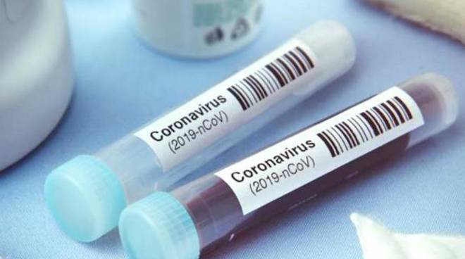 Coronavirus in Lombardia: oltre 3mila nuovi casi, in diminuzione rispetto a ieri