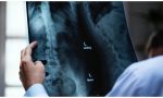 Radiografie a domicilio: quali sono i vantaggi?