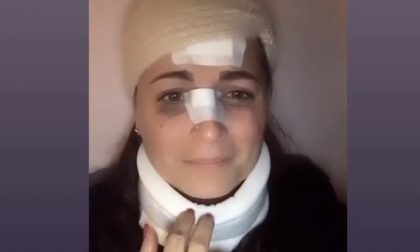 Operatrice sanitaria aggredita sul filobus VIDEO