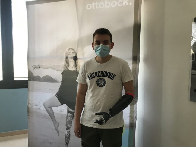 Mano bionica per Leonardo: il 16enne inizia una nuova vita
