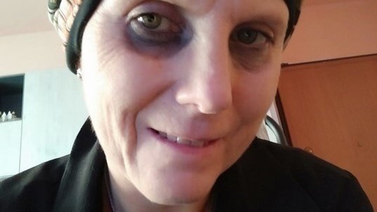 Daniela Molinari, la madre biologica dice sì al prelievo di sangue che può salvarla