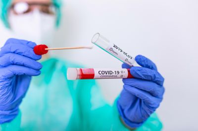 Coronavirus in Lombardia: solo 620 tamponi positivi