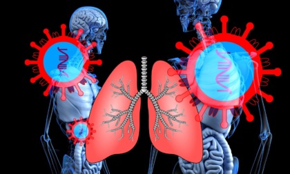 Danni polmonari a causa del Covid, Regione avvia monitoraggio sui pazienti che sono stati ricoverati