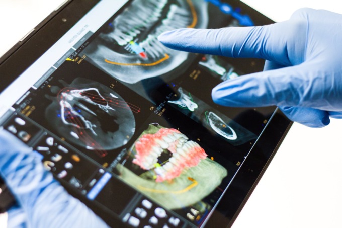Odontoiatria digitale: tutti i vantaggi per i pazienti