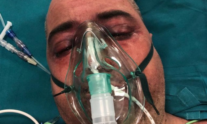 Rischiò la vita schiacciato da un bancale: rimasto invalido, ora è senza lavoro