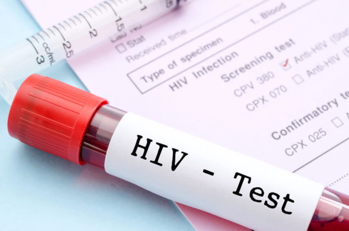 Quarant’anni di Hiv: informazione e prevenzione con il primo Giargiaforum