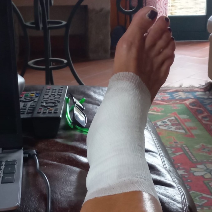 Il sindaco si è ferito ad una gamba con un attrezzo per tagliare la legna