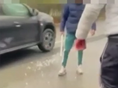 Sprangate fuori dalla scuola: tre 16enni finiscono in comunità
