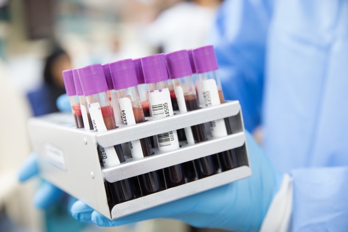 Esami del sangue: una chiave per la prevenzione e il monitoraggio della salute