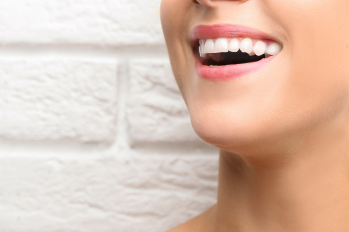 Sbiancamento dentale a Milano, ecco dove andare per denti 8 volte più bianchi