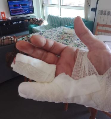 Aggredito da un molosso scappato  dall’area cani  del parco di via Terrazzano: «Colpa della rete “bucata”»