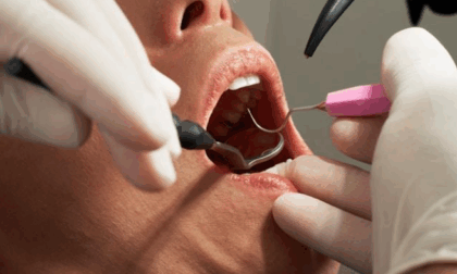 Come scegliere il migliore dentista di Milano