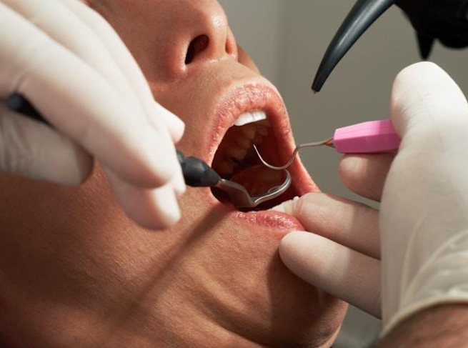 Come scegliere il migliore dentista di Milano