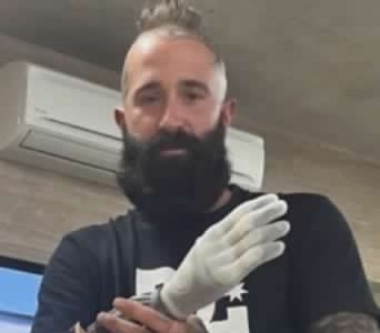 Cade, perde conoscenza e rompe il casco: l’atleta paralimpico Riccardo Cardani sotto osservazione in ospedale