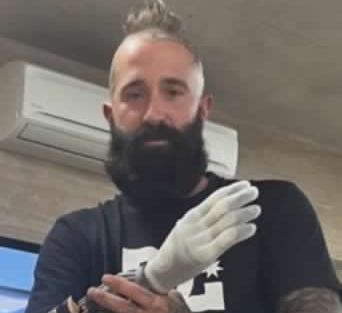 Cade, perde conoscenza e rompe il casco: l’atleta paralimpico Riccardo Cardani sotto osservazione in ospedale